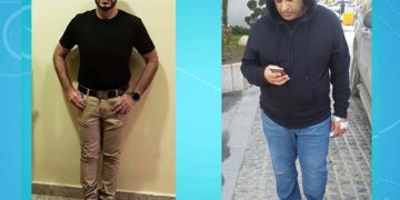 نتيجة عملية قص المعدة في إيران بعد 6 أشهر