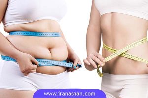 النظام الغذائي بعد جراحة انقاص الوزن في إيران