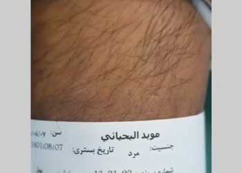 عملية تكميم المعدة لمريض من عمان في مستشفى باستور في طهران