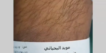 عملية تكميم المعدة لمريض من عمان في مستشفى باستور في طهران