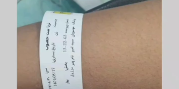 عملية تكميم المعدة في إيران ، 34 سنة bmi 38 من عمان