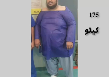 تكميم المعدة وزنها 175 كجم من باكستان للدكتور موسوي في طهران