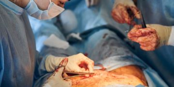 أفضل جراح تحويل مسار المعدة في إيران