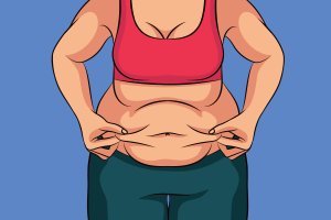 تكميم المعدة في إيران