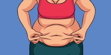 تكميم المعدة في إيران