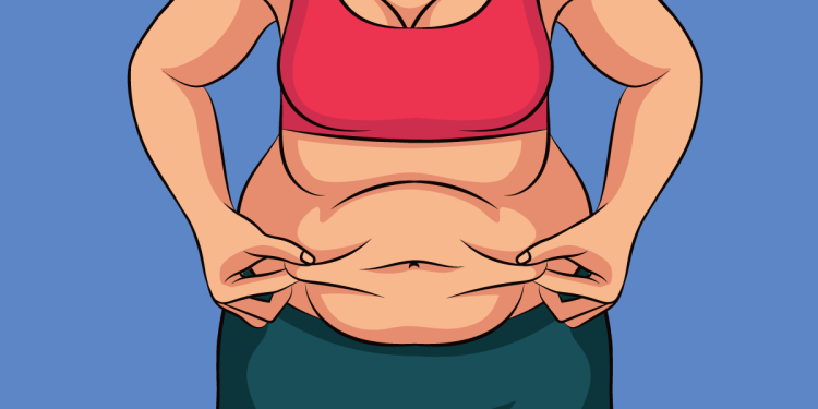 تكميم المعدة في إيران