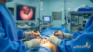 عملية تكميم المعدة