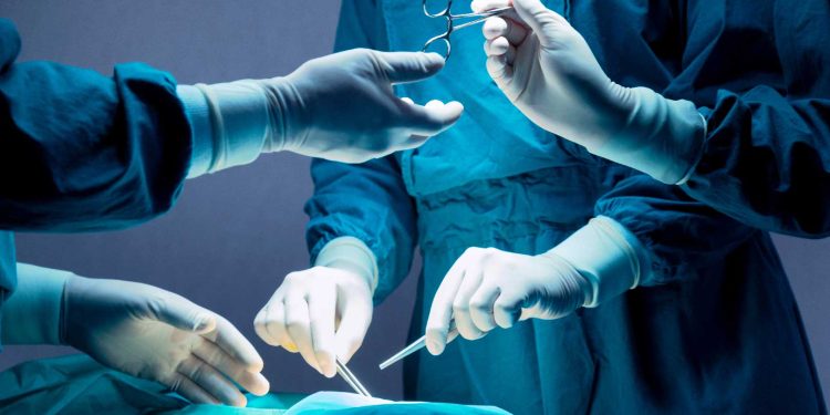 عملية تكميم المعدة